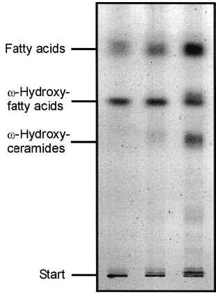 Epidermális lipidek atópiás dermatitisben az epidermis össz-lipid tartalma kb.