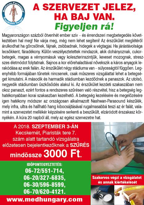 felújítások.