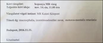 MR BEUTALÓ MR LELET Technikai leírás: Axiális FLAIR, T2, DWI/ADC, T2-FFE, 3D-TOF MRA valamint sagittális
