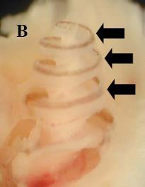 terminal Ribbon synapse