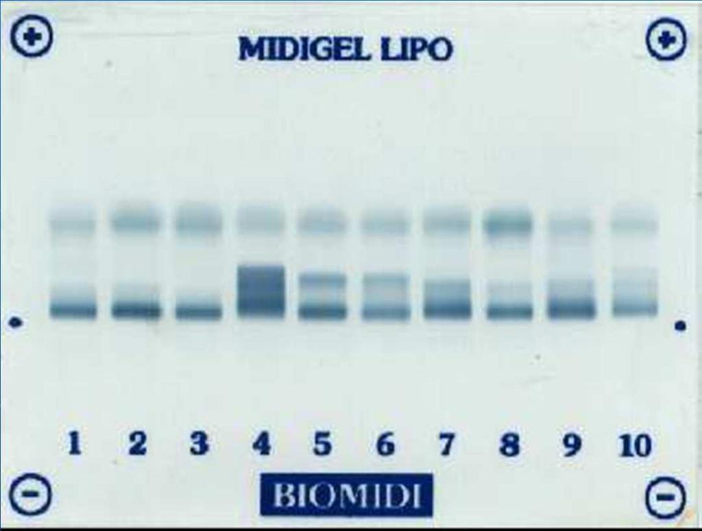 Lipoprotein elektroforézis HDL alfa VLDL (pre-beta) LDL (beta)