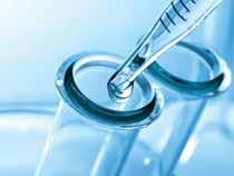 Zemplényi Antal Cost Effectiveness of Transcranial Magnetic Stimulation Compared to Antidepressants in
