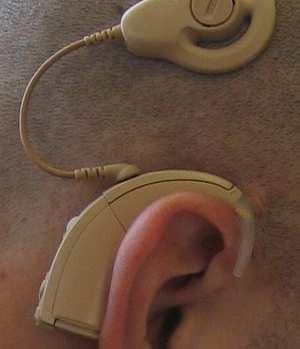 Cochlearis