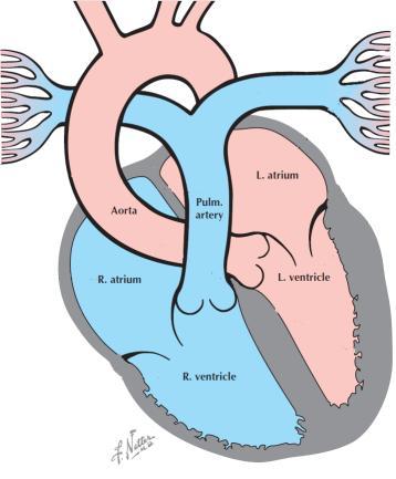 Paroxysmalis nocturnalis dyspnoe Asthma cardiale Cheyne-Stokes légzés Pulmonális ödéma Fáradékonyság Gyengeség Syncope Vénás túltöltöttség Objektív jelek SNS és RAAS