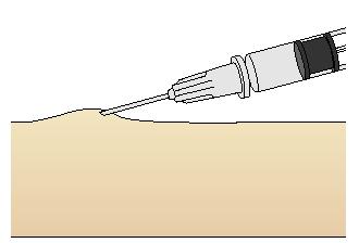 10%-os oldat pedig 100 mg/ml-t Példa Example: Egy 300 g-os patkánynak 25 mg/ttkg mebumalt (rövid hatású barbiturát) akarunk beadni.
