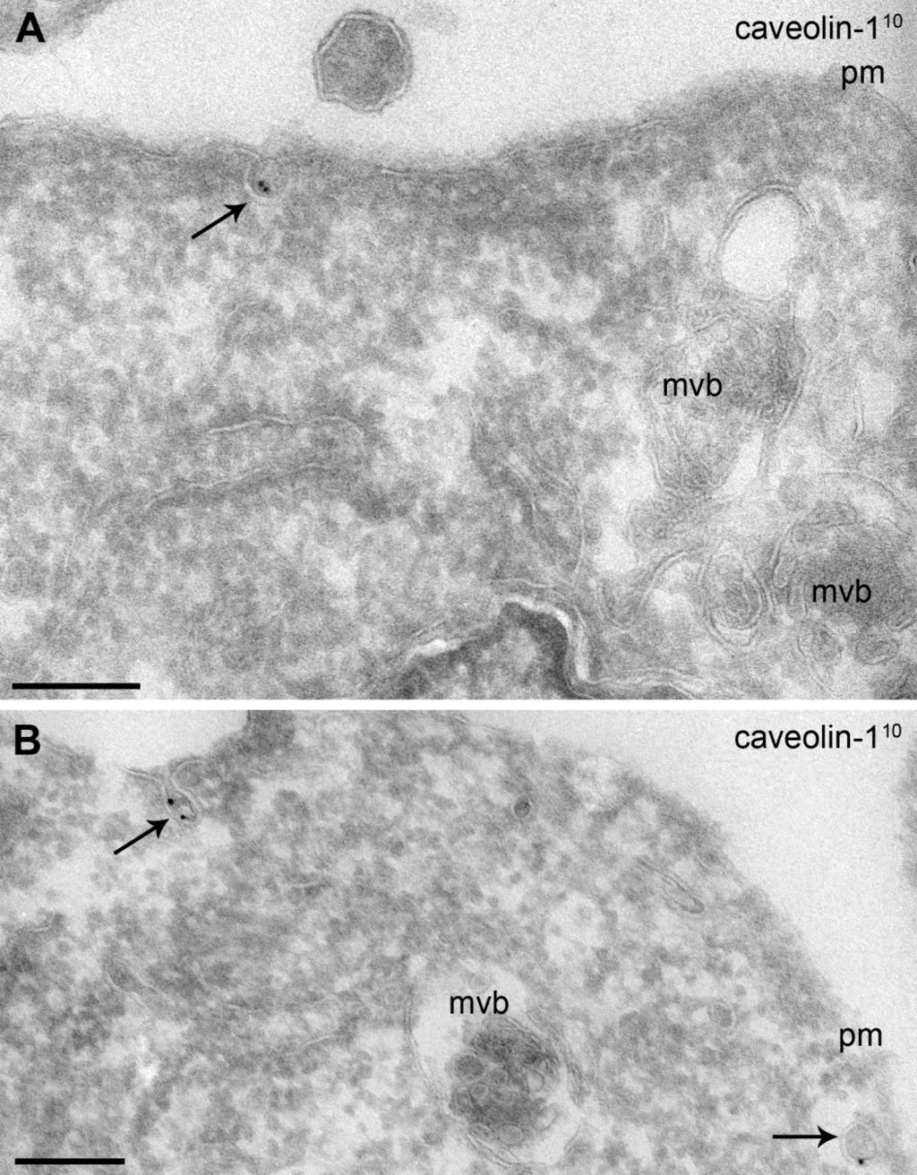 42. ábra: Fagyasztott ultravékony metszeten végzett caveolin-1 (10nm aranyszemcse) immunjelölés albumin megvonást követően. A.) és B.