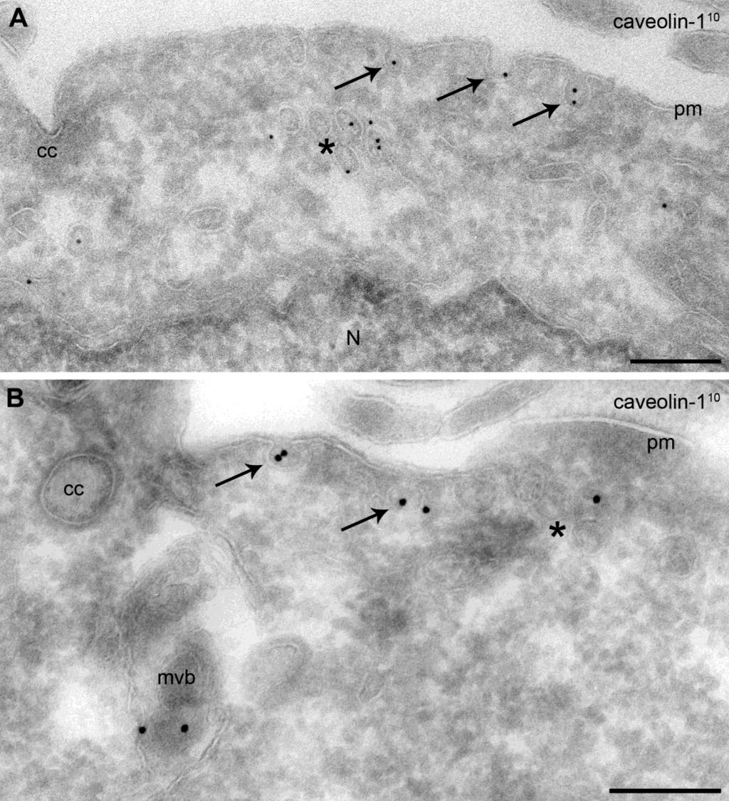 43. ábra: Fagyasztott ultravékony metszeten végzett caveolin-1 (10nm aranyszemcse) immunjelölés albumin inkubációt követően. A.