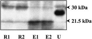 ábra: Reprezentatív Western blot analízis: VIP21/caveolin-1 azonosítása rezidens (R) és elicitált (E) makrofágokban. U: uterus simamizom (kontrol) A B 14.