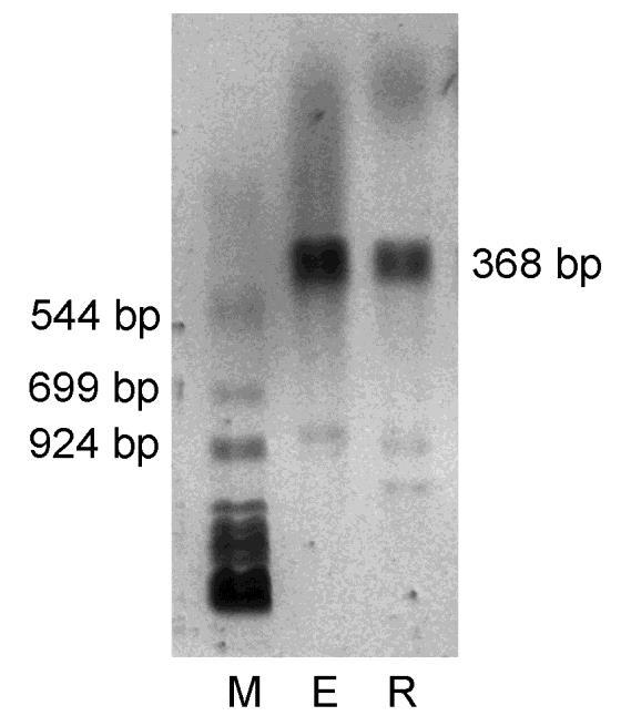 Caveolin RT-PCR analízis: RT-PCR technika alkalmazásával mind az elicitált mind pedig a rezidens makrofágokban különböző molekulatömegű produktumokat sikerült azonosítanunk.