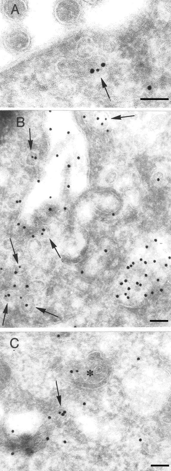 23. ábra: Kettős jelöléses immuncitokémia fagyasztott ultravékony metszeten. Szérum albumin (nagyobb aranyszemcsék) és caveolin-1 (kisebb aranyszemcsék) kimutatása.