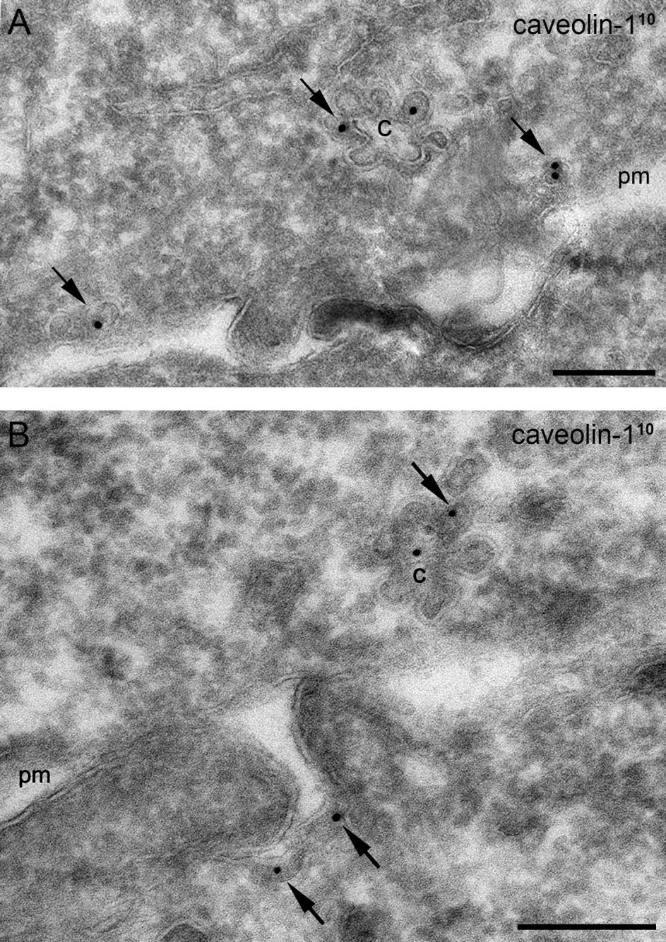 37. ábra: Okadánsav kezelés után rozetta formájú organellumok (caveoszómáknak tartott struktúrák) jelenléte HepG2 sejtekben.