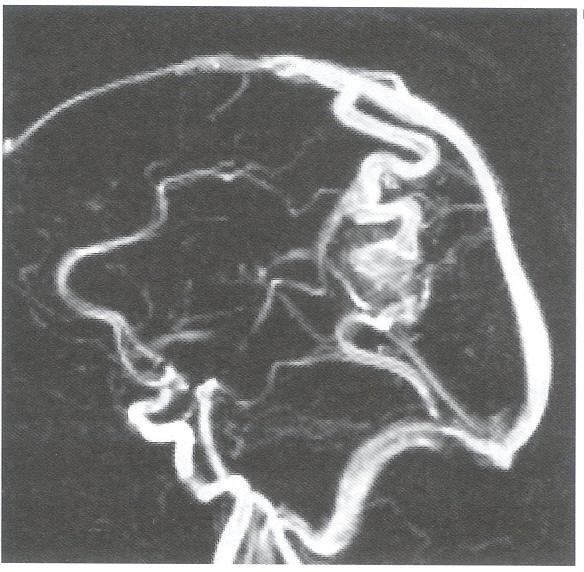 V.Speciális MRI technikák fejlődési irányok 1.