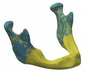 Department of Oral and Maxillofacial Surgery, University Hospitals of Leicester ABSTRACT.