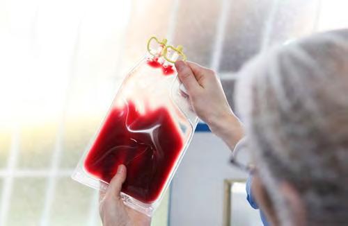Hemopoetikus őssejt-transzplantáció Apa: haploidentikus transzplantáció o negatív TCR αβ és CD19