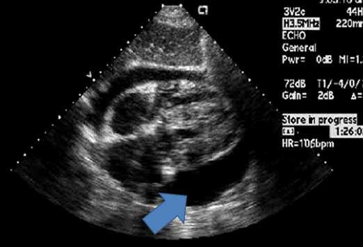 Sürgősségi ultrahang diagnosztika- betegellátás