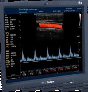 Fejlett képalkotó technológia źthi źµ-scan, szemcse műtermék csökkentés (opcionális) źcompound