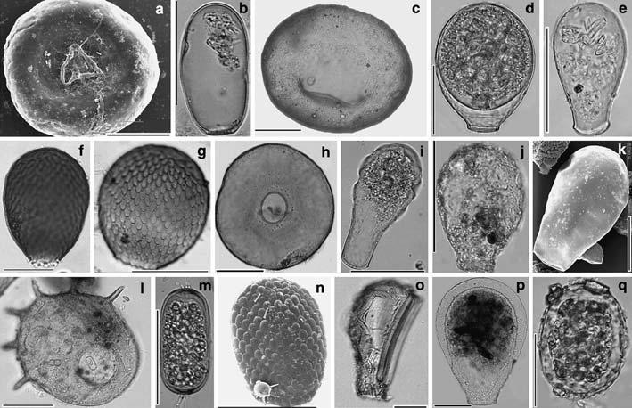 Házas amőba (Testacea) rekonstrukció Egysejtű protisták 20µm-200µm Szilikátos meszes burok Faji szintű azonosítás Tőzeges és tavi üledékekben fosszilizálódnak Házas amőbák környezeti tényezők