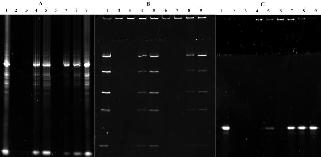 16. ábra: Nukleinsav-7ap gél retardációs teszt. (A) RNS és 7ap kölcsönhatása. 1. sáv: 1,3 µg RNS; 2-5.: 1,3 µg RNS+Hu7ap felező hígításban (10 µg, 5 µg, 2.