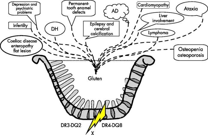 Kaukinen, K. et al.