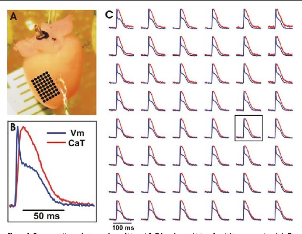 CaT + AP mapping Ca 2+ -, illetve potenciál-szenzitív festékekkel