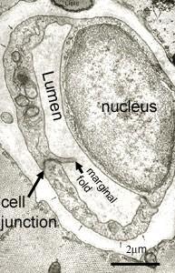kapilláris lumene szeparált a sejtek közötti tértől: agyi kapillárisok, EM kép: 2