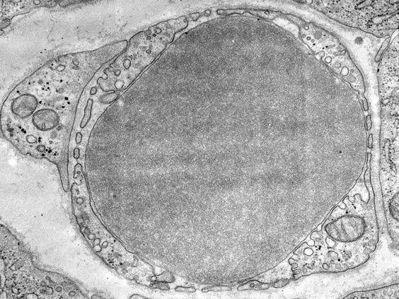 Ablakos kapilláris: Az endothel sejtek pórusokkal átjártak amelyek csator naként funkcionálnak és lehetővé teszik a kapilláris falon
