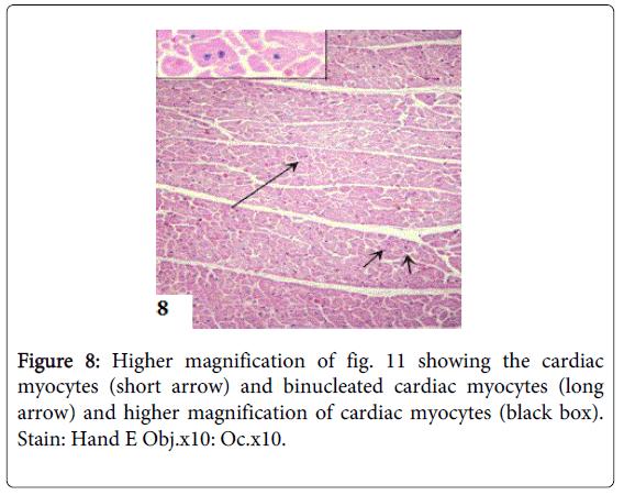 Myocardium. A pitvarok izomzata kétrétegű. A külső falrétegen a sejtnyalábok lefutása nagyobbára körkörös, azaz a sulcus coronarius síkjával párhuzamos.