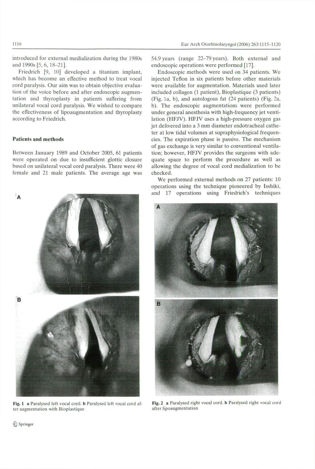 1116 introduced for e x t e r n a l medialization during t h e 1980s and 1990s [5, 6, 1 8-2 1 ], Friedrich [9, 10] d e v e l o p e d a titanium implant, which has b e c o m e an effective m e t h o d