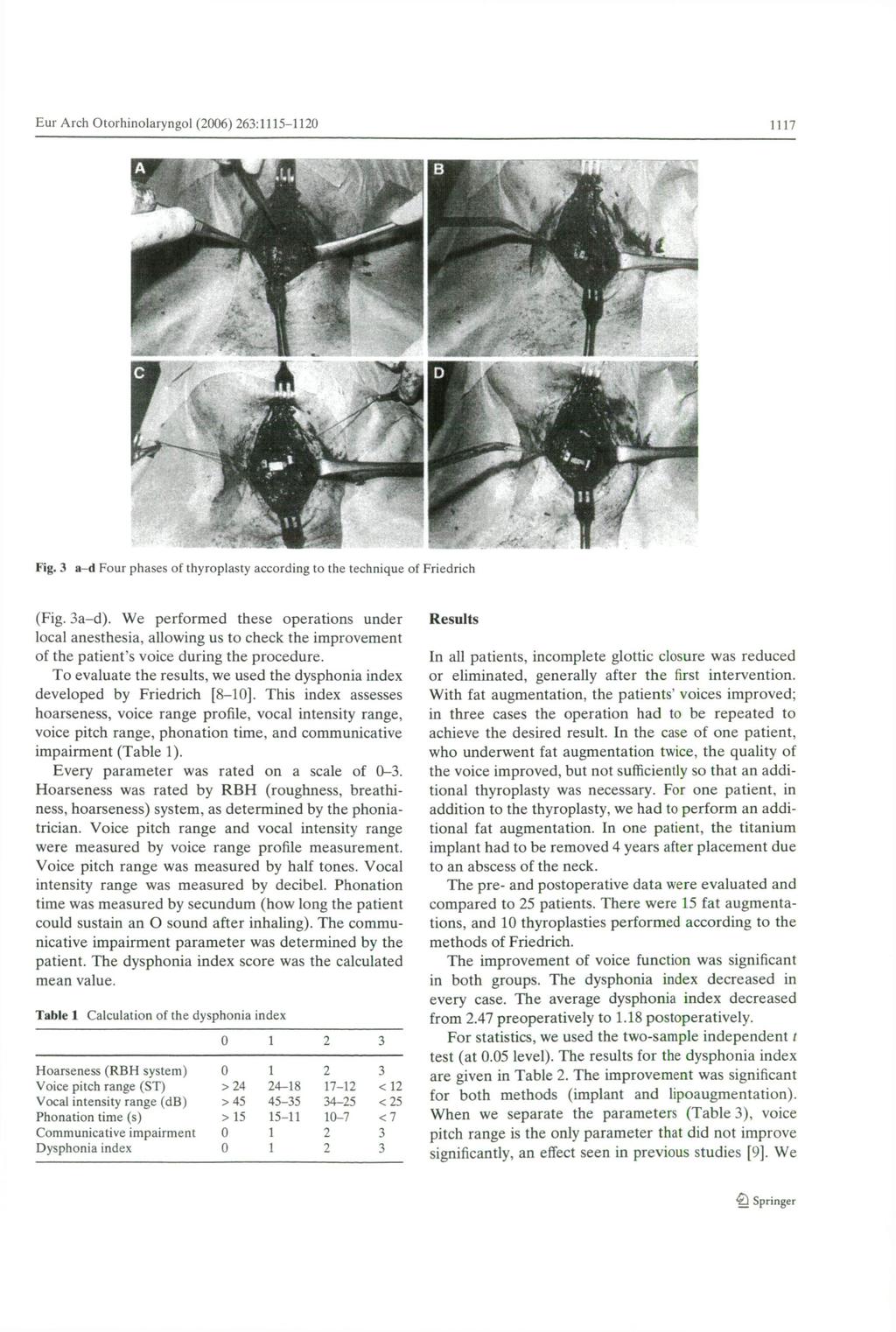 1117 Eur Arch Otorhinolaryngol (2006) 263:1115-1120 Fig. 3 a-d Four phases of thyroplasty according to the technique of Friedrich (Fig. 3a-d).