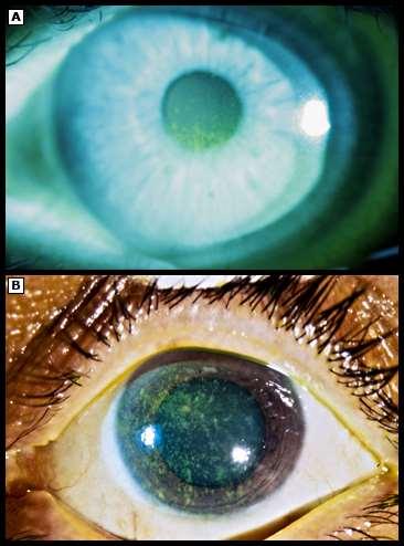 Fluorescein