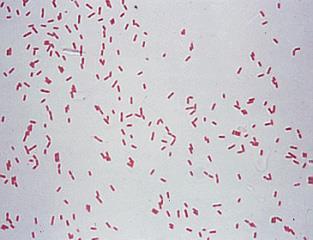 Gram  (Pseudomonas