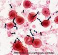 Gram pozitív coccus láncok