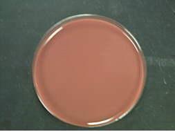 - csokoládé agar: hőkezelt véres agar még igényesebb baktériumoknak (