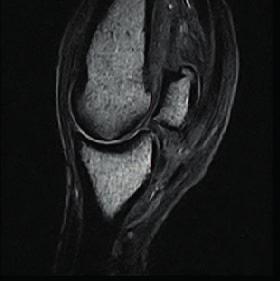 A szedált állapotban történő MRI vizsgálat világszerte elismert módja az anatómiai képalkotó vizsgálatoknak, mely anélkül történik, hogy a képminőség romlana.