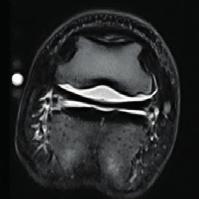 lehetővé. Az O-scan az ideális, költséghatékony MRI megoldás, ami elengedhetetlen az optimális diagnózis felállításához.