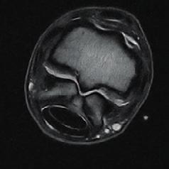 A megvétel előtti vizsgálat (PPE, Pre-Purchase Examination) teljes egészében és hatékonyan elvégezhető az O-scan rendszerrel, így a muszkuloszkeletális