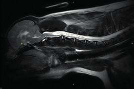 Ezt az innovatív MRI készüléket kifejezetten a