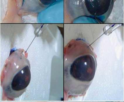 retinitis helyi kezelésére használatos Általában immunszuppresszált betegekben A CMV egy nélkülözhetetlen