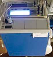 A DIABETESES LÁB KOMPLEX VIZSGÁLATA 1. kép. Laser-Doppler áramlásmérő készülék Picture 1. Laser-Doppler flow measuring device rögzítettük.