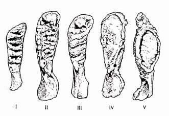 2./ A femur proximalis epiphysisének belső szerkezeti változása (F) 3.