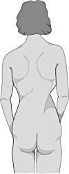 IX. Ortopédiai szűrés kivitelezése 77 ADOLESCENS IDIOPATHIAS SCOLIOSIS A gerincferdülés serdülőkori formája, melynek során a csigolyák az érintett szakaszon elfordulnak, de a háti domborulat csökken.