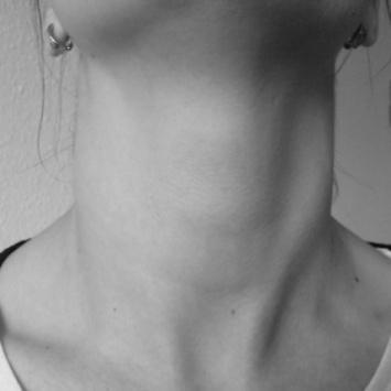 jódhiány thyreoiditis Basedow-kór cysta adenoma carcinoma Diffúz golyva okai Göbös golyva formái X./4 