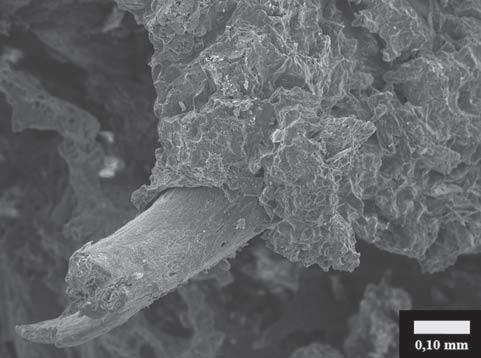 Scleroticus góc elektronmikroszkópos képe A szeméremcsont eredeti, pusztulófélben lévő csontgerendáit körbefogó rendezetlen szerkezetű újcsontréteg. (Kr. u. V. sz., Esztergom Bánomi dűlő lelőhely 284/A sír, 40 50 éves nő).