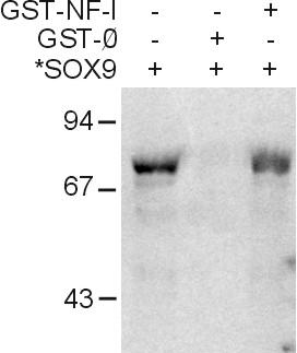 61 13. ábra: A SOX9 és NF-I faktorok in vitro kölcsönhatásának vizsgálata.