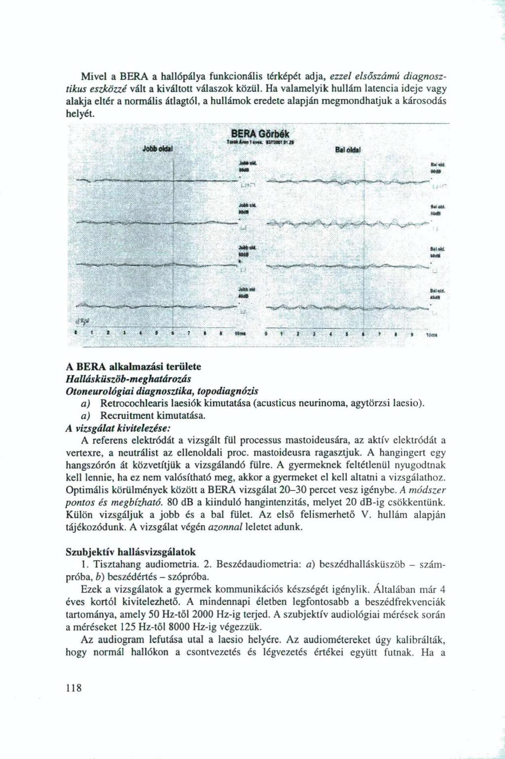 Mivel a BERA a hallópálya funkcionális térképét adja, ezzel elsőszámú diagnosztikus eszközzé váll a kiváltott válaszok közül.