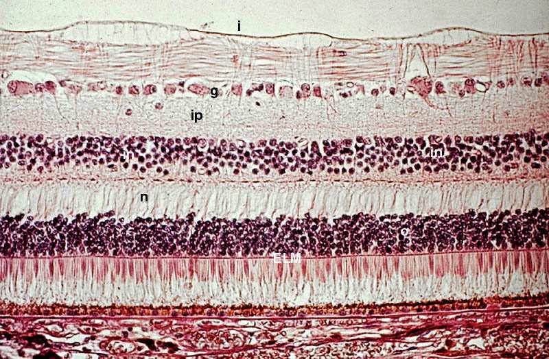 Látóhártya = retina (recehártya) Előadás Általános Orvostudományi