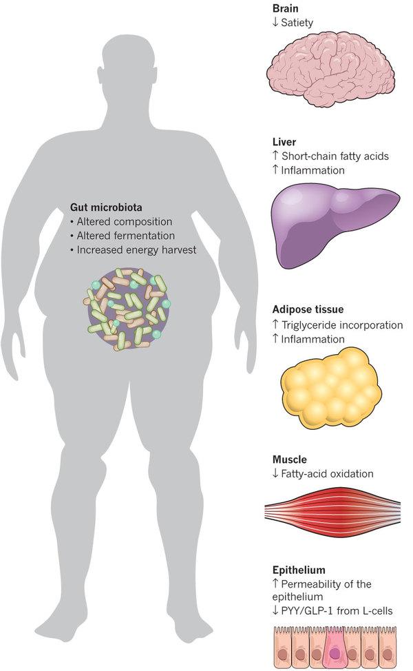 Bél mikrobiota és kapcsolata - Metabolism - Obesity