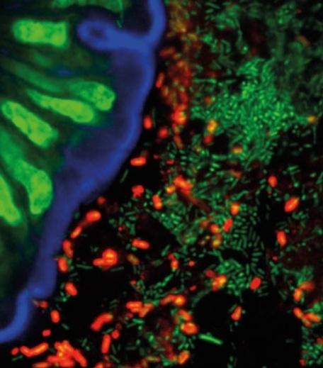 life colonization of the GI tract of newborns