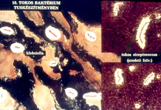 Klebsiella genus Morfológia: - Gram-negatív pálca -