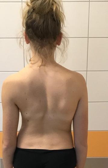 A kórházi befekvéshez szükséges: néhány váltás ruhanemű (pólók, melegítő, fehérnemű, pizsama/hálóing, papucs), tisztálkodó szerek, szabadidős eszközök (könyv, laptop, telefon, ipad fülhallgatóval